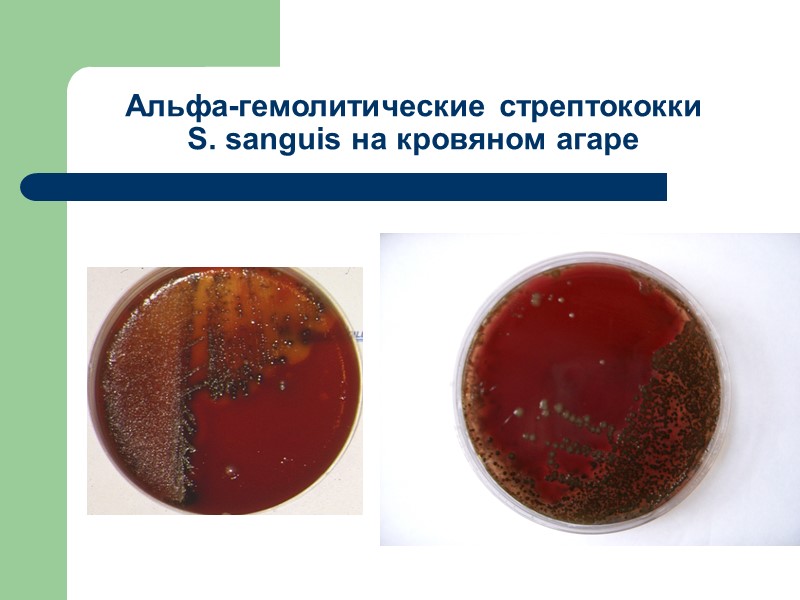 Альфа-гемолитические стрептококки  S. sanguis на кровяном агаре